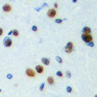 NPAS4 Rabbit Polyclonal Antibody
