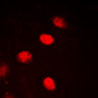 NPAS4 Rabbit Polyclonal Antibody