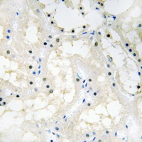 NR2F2 Rabbit Polyclonal Antibody