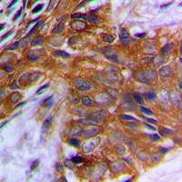 PAK1 (Phospho-T212) Rabbit Polyclonal Antibody