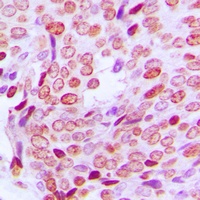 PFDN1 Rabbit Polyclonal Antibody