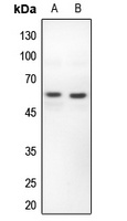 PFKFB2 Rabbit Polyclonal Antibody