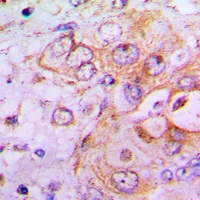 PFKFB2 Rabbit Polyclonal Antibody