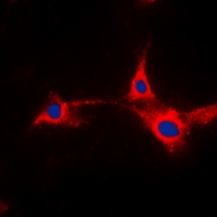 PFKFB2 Rabbit Polyclonal Antibody