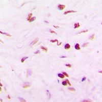 PINX1 Rabbit Polyclonal Antibody