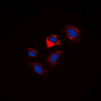 Phospholamban (Phospho-S16/T17) Rabbit Polyclonal Antibody
