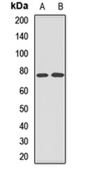 TOM70 Rabbit Polyclonal Antibody