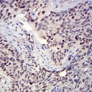 Histone H3 (Acetyl-K27) Mouse Monoclonal Antibody