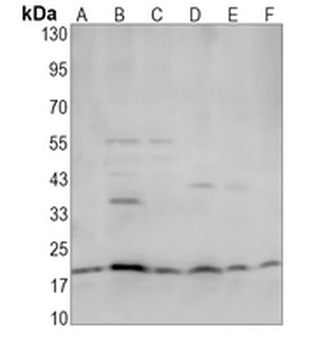 IL-15 Rabbit Monoclonal Antibody
