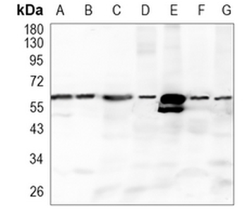 Catalase Rabbit Monoclonal Antibody