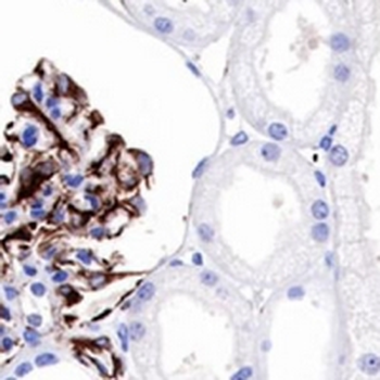 Nestin Rabbit Monoclonal Antibody