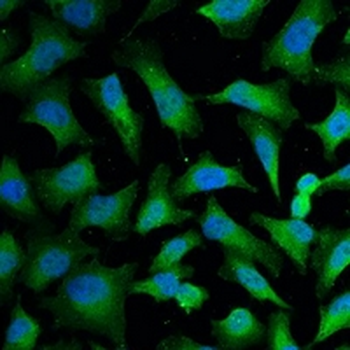 Cytokeratin 18 Mouse Monoclonal Antibody