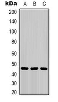 Cytokeratin 18 Mouse Monoclonal Antibody