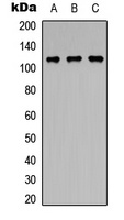 PPP1R13B Rabbit Polyclonal Antibody