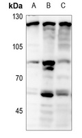 Focal Adhesion Kinase (Phospho-Y397) Rabbit Polyclonal Antibody