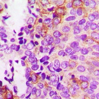 Focal Adhesion Kinase (Phospho-Y397) Rabbit Polyclonal Antibody