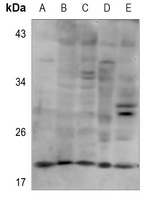 PXMP2 Rabbit Polyclonal Antibody
