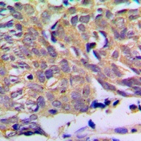 PXMP2 Rabbit Polyclonal Antibody