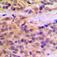 RAB11FIP1 Rabbit Polyclonal Antibody