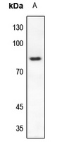 RAD17 Rabbit Polyclonal Antibody