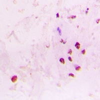 RAD17 Rabbit Polyclonal Antibody