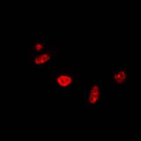 RAD17 Rabbit Polyclonal Antibody
