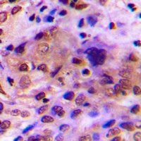 RAD51C Rabbit Polyclonal Antibody