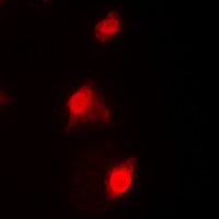 RAD51C Rabbit Polyclonal Antibody