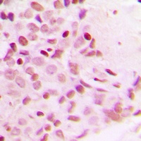 NF-kappaB p65 (Phospho-T254) Rabbit Polyclonal Antibody