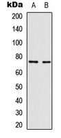 NF-kappaB p65 (Phospho-T435) Rabbit Polyclonal Antibody
