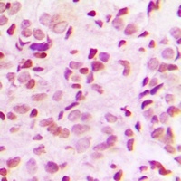 NF-kappaB p65 (Phospho-T435) Rabbit Polyclonal Antibody
