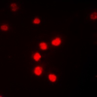 NF-kappaB p65 (Phospho-T435) Rabbit Polyclonal Antibody