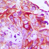 RET (Phospho-Y1062) Rabbit Polyclonal Antibody