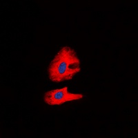 RET (Phospho-Y1062) Rabbit Polyclonal Antibody