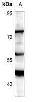 RIPK3 Rabbit Polyclonal Antibody