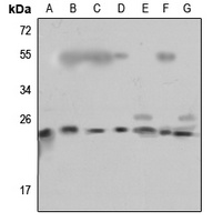 RPL18 Rabbit Polyclonal Antibody