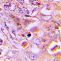 RPL18 Rabbit Polyclonal Antibody