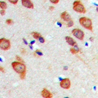 RPL22 Rabbit Polyclonal Antibody