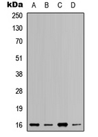 RPL37A Rabbit Polyclonal Antibody