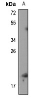 RPS19BP1 Rabbit Polyclonal Antibody