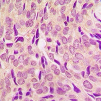 RPS6 (Phospho-S240) Rabbit Polyclonal Antibody