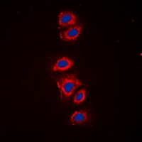 RPS6 (Phospho-S240) Rabbit Polyclonal Antibody