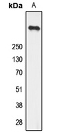 Ryanodine Receptor 2 (Phospho-S2808) Rabbit Polyclonal Antibody