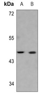 Serpin B3/4 Rabbit Polyclonal Antibody
