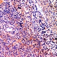 Serpin B3/4 Rabbit Polyclonal Antibody