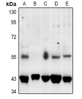 SGK1/2 (Phospho-T256/253) Rabbit Polyclonal Antibody