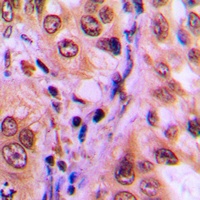 SGK1/2 (Phospho-T256/253) Rabbit Polyclonal Antibody