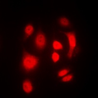 SGK1/2 (Phospho-T256/253) Rabbit Polyclonal Antibody