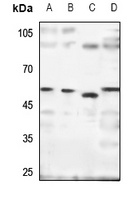 SH2D4A Rabbit Polyclonal Antibody