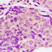 SH2D4A Rabbit Polyclonal Antibody